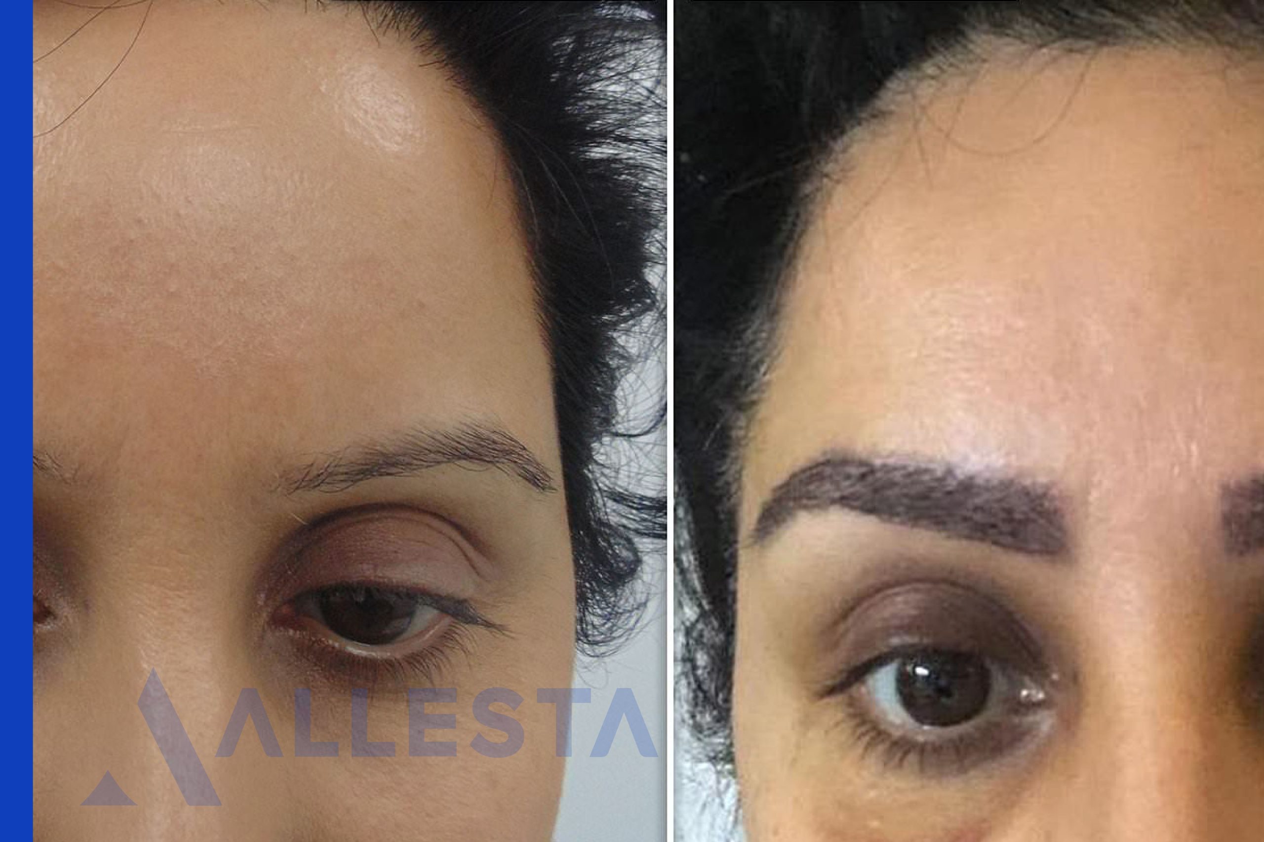 Before and after2-01