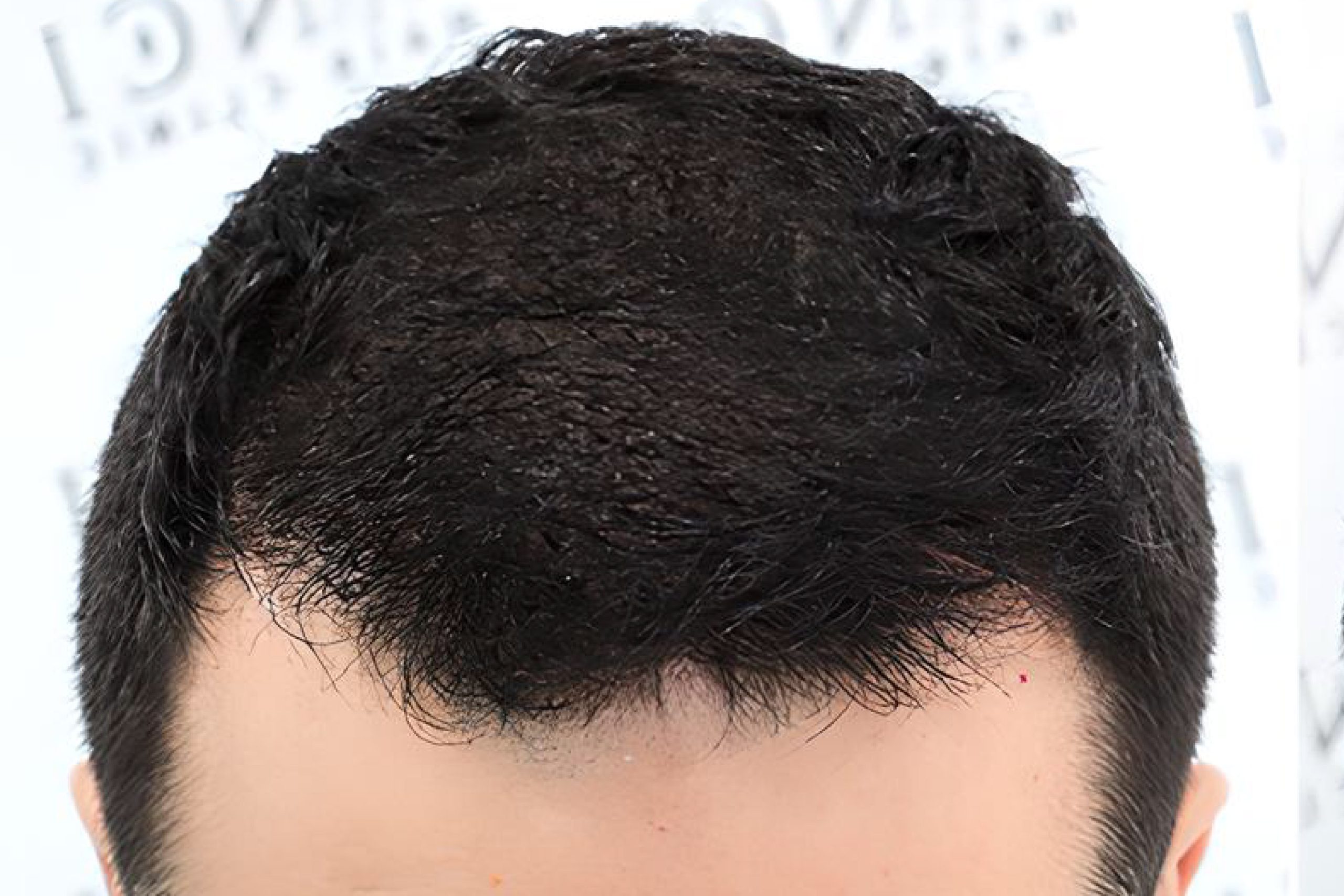 After